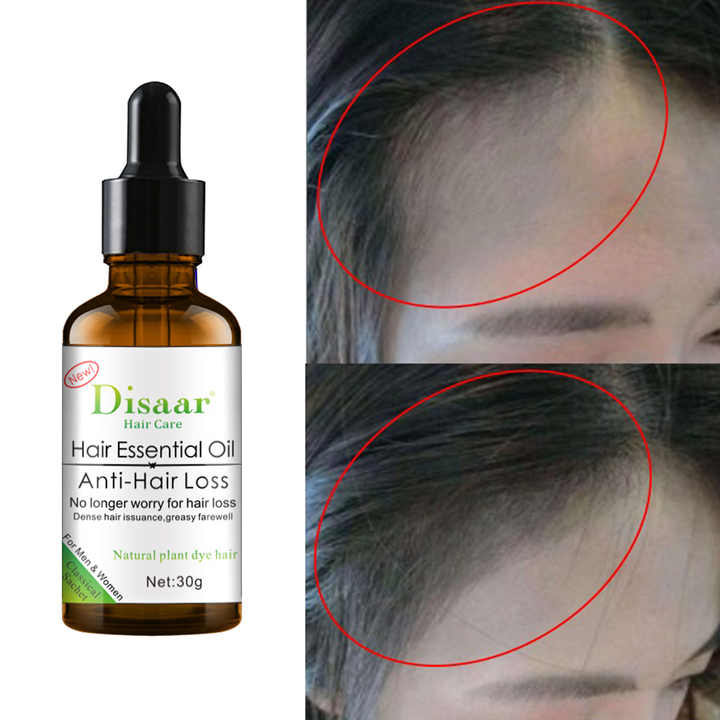 Huile Revitalisante pour la Pousse des Cheveux